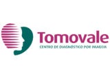 Tomovale